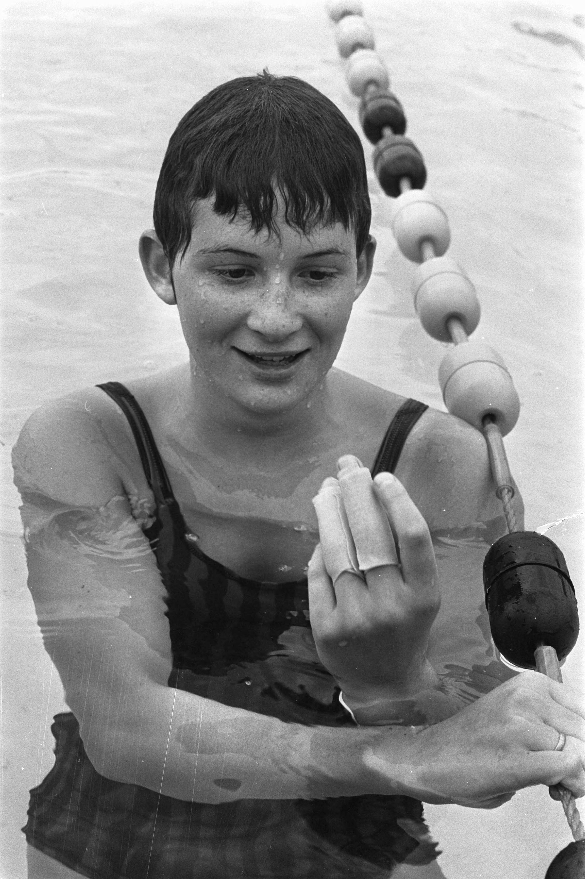Fotocollectie Anefo — Nationale zwemkampioenschappen in Leeuwarden; Frieke Buys met geblesseerde hand — Foto: Verhoeff, Bert / Anefo. Licentie: Set B: Rechtenvrij / Publiek Domein. Bron: Nationaal Archief. http://hdl.handle.net/10648/ab9d9a5a-d0b4-102d-bcf8-003048976d84